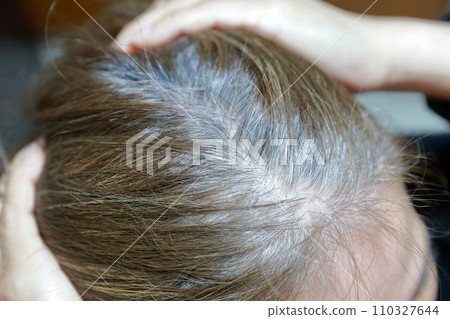 A woman with noticeable gray hair on her hairline 110327644
