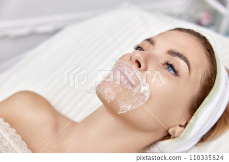 woman with anesthesia cream on lips before procedure lip augmentation 110335824