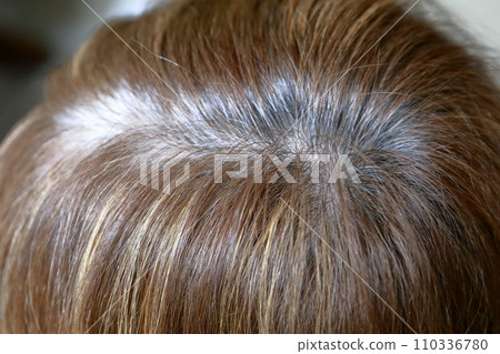 髮際線上有明顯白髮的女性 髮際線上有明顯白髮的女性 110336780