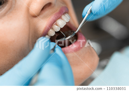 The dentist provides gentle and convenient service, explaining each stage of treatment to the patient. She has high skills and the ability to provide comfort during the visit. Close-up tools The dentist provides gentle and convenient service, explaining each stage of treatment to the patient. She has high skills and the ability to provide comfort during the visit. Close-up tools 110338031