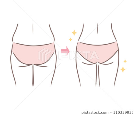 下垂且寬的甜椒屁股和苗條屁股的插圖 - 比較/之前和之後 110339935