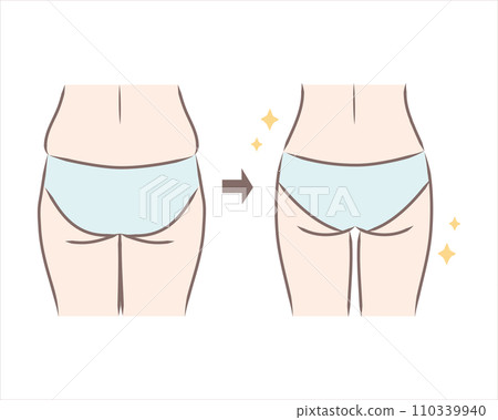 Illustration of a saggy and wide bell pepper butt and a slim butt - comparison/before and after 110339940