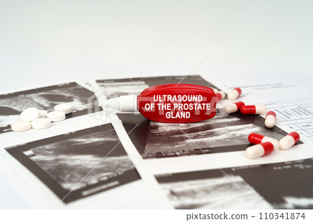 On the ultrasound pictures there are pills and a pen with the inscription - Ultrasound of the prostate gland On the ultrasound pictures there are pills and a pen with the inscription - Ultrasound of the prostate gland 110341874