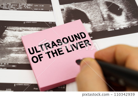 On the ultrasound pictures there are stickers that say - Ultrasound of the liver 110342939