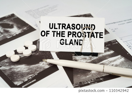 On the ultrasound pictures there is a pen and a business card with the inscription - Ultrasound of the prostate gland 110342942