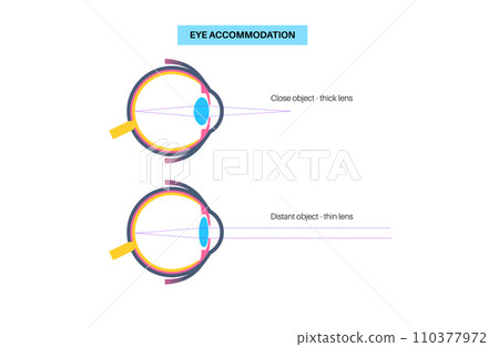 Eye accommodation poster Eye accommodation poster 110377972