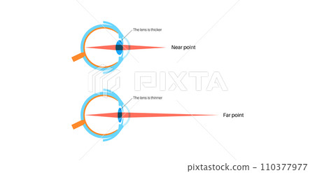Eye accommodation poster 110377977