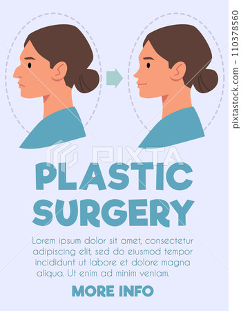 Rhinoplasty web banner for landing page. Rhinoplasty web banner for landing page. 110378560