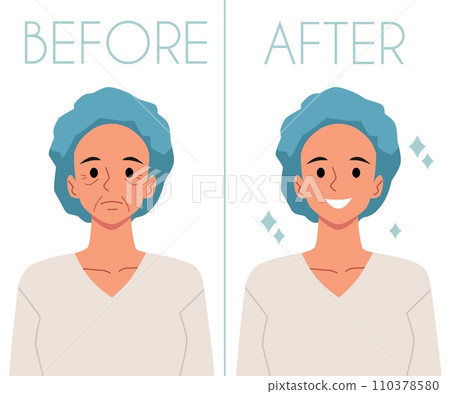 Correction plastic surgery, woman with wrinkles on face Before and lady with a smooth skin After, vector facial lift Correction plastic surgery, woman with wrinkles on face Before and lady with a smooth skin After, vector facial lift 110378580