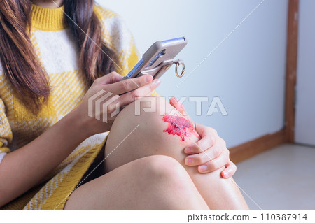 一名膝蓋受傷的年輕女子操作智慧型手機的手 110387914