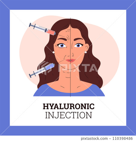 Before and after hyaluronic injection woman's face concept vector illustration 110398486