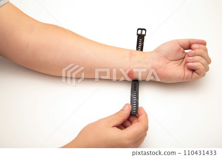 Irritation, redness and itching on the skin after wearing a watch or fitness bracelet. Allergy to watch strap, contact dermatitis, close-up 110431433