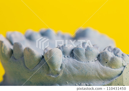Blue plaster model of an impression of a patient's jaw at an orthodontist dentist on a yellow background. Manufacturing of dentures and crowns for dental prosthetics in orthodontics, macro. Copy space 110431450