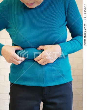 一位患有肥胖症的老年婦女的前視圖 110435655