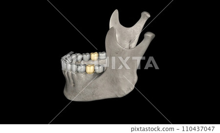 The mandibular second molar resembles the mandibular first permanent molar 110437047
