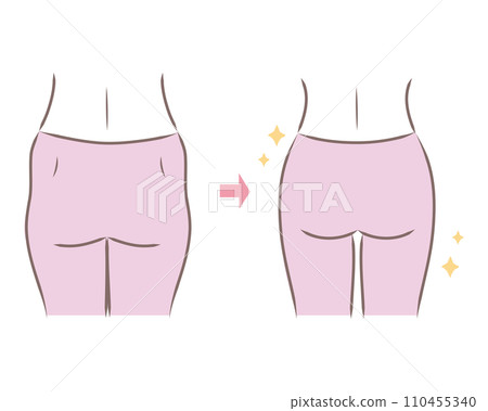 Illustration of a saggy and wide bell pepper butt and a slim butt - comparison/before and after 110455340