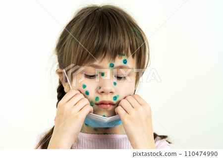 Child girl wearing blue protective medical mask ill with chickenpox, measles or rubella virus with rashes on body. Children protection during epidemic of coronovirus. Covid-19 contagion concept. Child girl wearing blue protective medical mask ill with chickenpox, measles or rubella virus with rashes on body. Children protection during epidemic of coronovirus. Covid-19 contagion concept. 110474990
