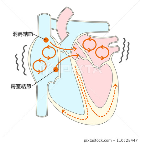 心房顫動時心臟傳導系統的圖示 心房顫動時心臟傳導系統的圖示 110528447