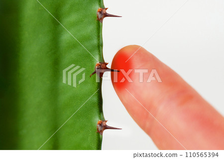 Painful finger prick from a cactus thorn. Red skin from inflammation. Pain concept Painful finger prick from a cactus thorn. Red skin from inflammation. Pain concept 110565394