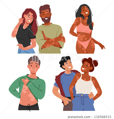 Joyful Characters Proudly Embracing Their Unique Beauty. People Celebrating Diversity With Vitiligo Radiating Confidence 110566515