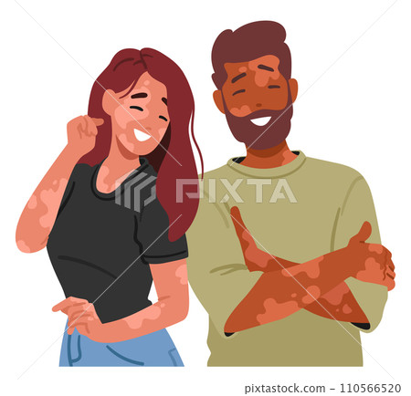 Joyful Couple Characters With Vitiligo, Celebrating Love And Uniqueness. Their Smiles Radiate Acceptance 110566520