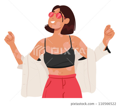 Joyful Woman With Vitiligo Embraces Her Unique Beauty, Radiating Confidence And Positivity, Vector Illustration 110566522