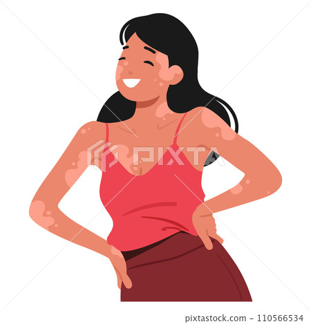 Joyful Woman Embraces Her Unique Beauty With Vitiligo, Radiating Confidence And Self-love, Vector Illustration 110566534