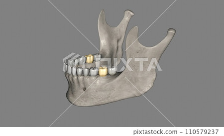 The mandibular second molar resembles the mandibular first permanent molar 110579237