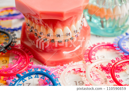 Orthodontic ligatures rings and ties, elastic rubber bands on orthodontic braces, model for dentist studying about dentistry. Orthodontic ligatures rings and ties, elastic rubber bands on orthodontic braces, model for dentist studying about dentistry. 110590859