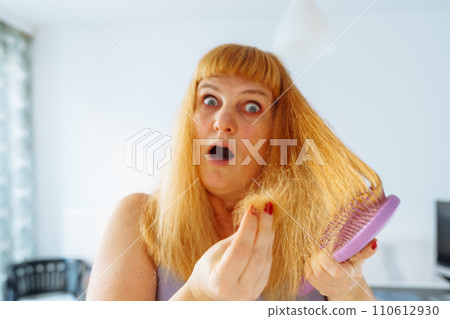 hair loss in middle-aged women hair loss in middle-aged women 110612930