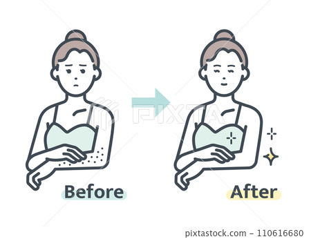 Before and after arm hair removal 110616680