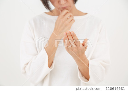 A middle-aged woman suffering from dry and chapped hands 110616681