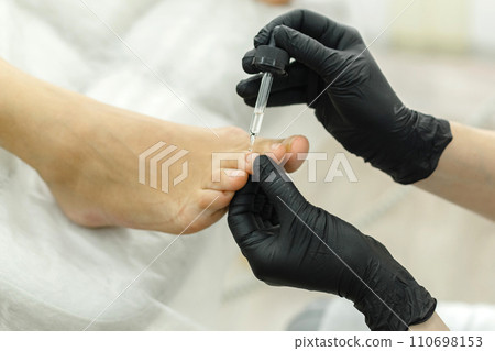 The pedicure master applies a softening oil or a medicinal product in a pipette to the nails The pedicure master applies a softening oil or a medicinal product in a pipette to the nails 110698153