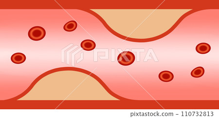 換句話說，血管 110732813