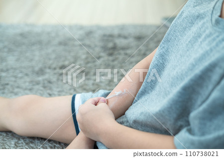 Little Asian boy's hands peeling off dry skin on his arm. Skin problems. 110738021