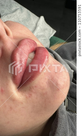 Lush, plump lips. Lush, plump lips. 110753591