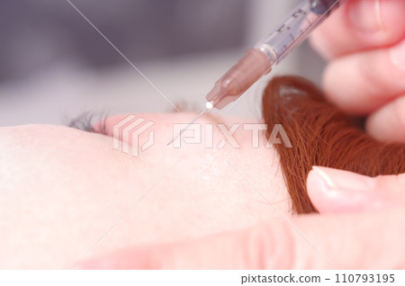 A woman receiving an injection in her eyes A woman receiving an injection in her eyes 110793195