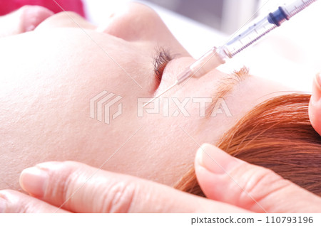 一名女子眼睛接受注射 一名女子眼睛接受注射 110793196