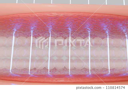 Laser shot through skin layer to collagen for Saggy skin and Facial treatment.  110814574