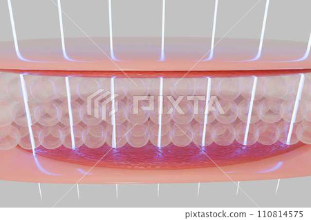 Laser shot through skin layer to collagen for Saggy skin and Facial treatment.  110814575