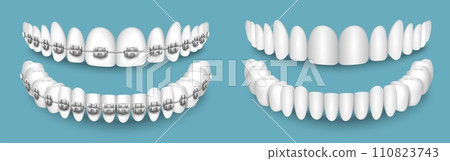 Teeth with or without braces orthodontic dentistry Teeth with or without braces orthodontic dentistry 110823743
