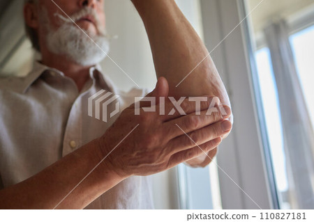 Senior man lubricating with analgetic cream his elbow. 110827181