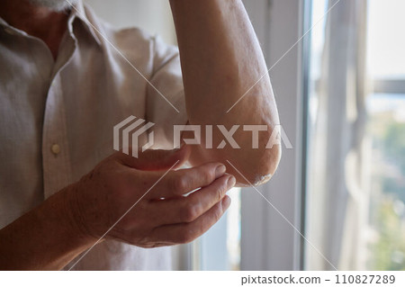 Senior man lubricating with analgetic cream his elbow. Senior man lubricating with analgetic cream his elbow. 110827289