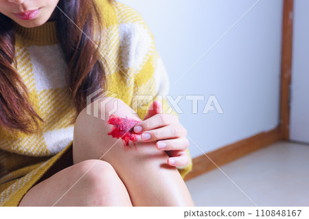 A woman sitting on the floor with scraped knees (no face) 110848167