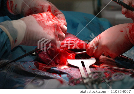 Surgery 110854007