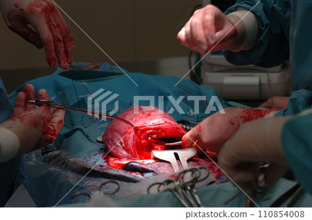 doctor performing surgery doctor performing surgery 110854008