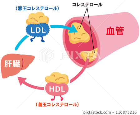 LDL和HDL血脂異常的機制 血管 膽固醇 110873216