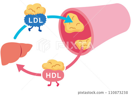 LDL和HDL血脂異常的機制 血管 膽固醇 110873238