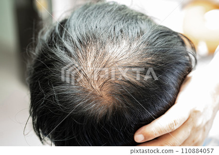 Bald in the middle head and begin no loss hair glabrous of mature Asian business smart active office man. 110884057