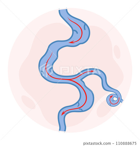 Varicose veins. Blue blood vessel visible through the skin. Vascular disease diagnostic and treatment. Venous insufficiency medical Varicose veins. Blue blood vessel visible through the skin. Vascular disease diagnostic and treatment. Venous insufficiency medical 110888675